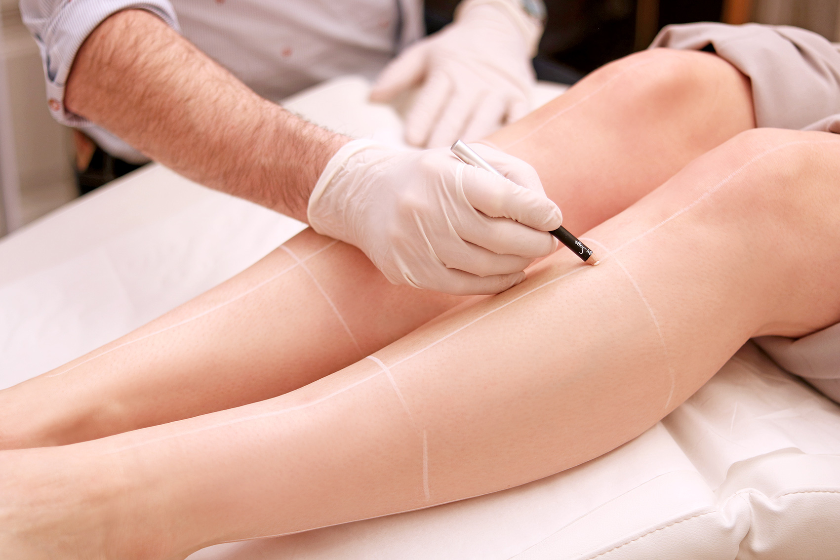 avis-epilation-laser-definitive-lyon